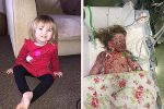 Faye Burdett's parents are appealing for all children to be appeal to receive the Men B jab
