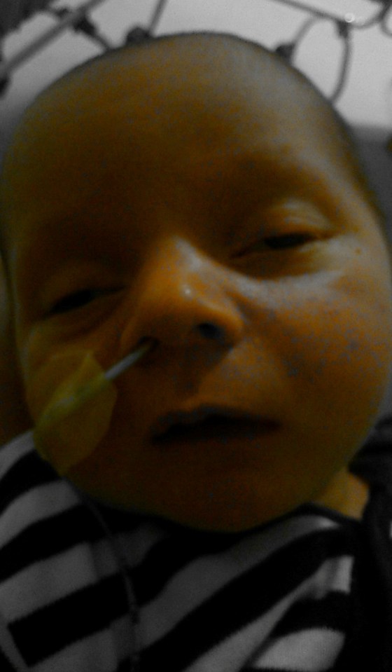 The midwife helping to care for Brian decided not to conduct the jaundice test