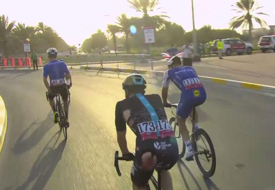 This was the nasty looking injury suffered by British cyclist Owain Doull in Abu Dhabi