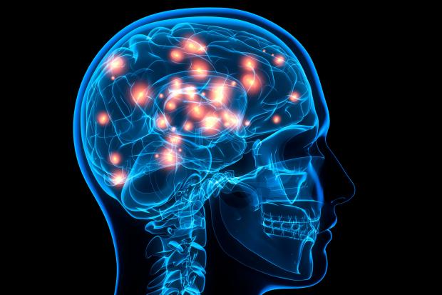 Dementia is a degenerative brain disease that causes memory loss, difficulty thinking and problems with speech