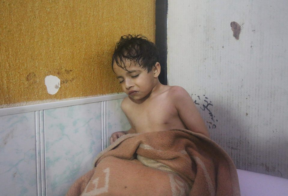  A Syrian child waits to receive medical treatment after Assad regime forces allegedly conducted poisonous gas attack in eastern Ghouta