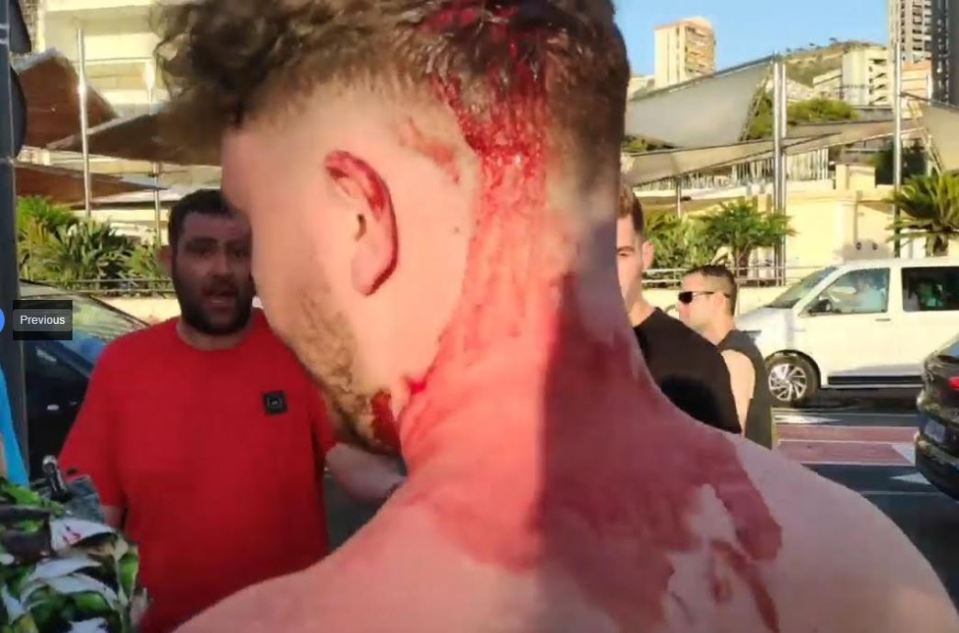  Blood spilled from a gash on the back of the man's head after he tried to stand up to the street con men