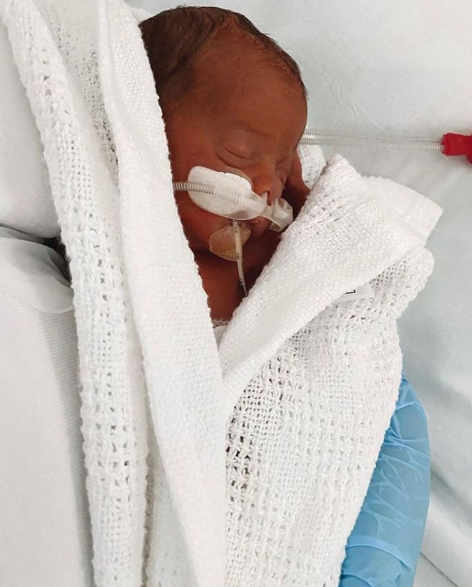 The pair's little boy Romeo was born 11 weeks early