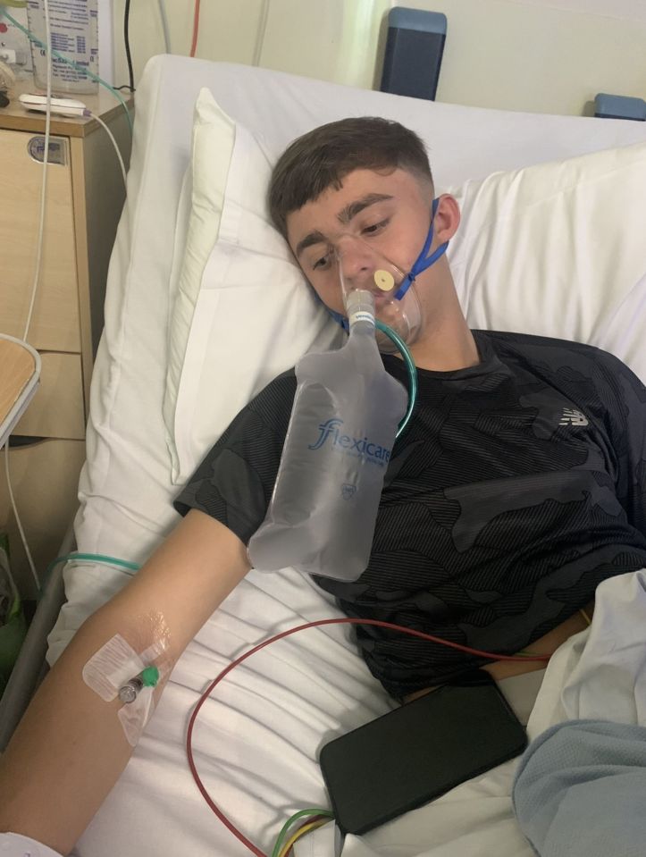 Alex Littler’s lung ruptured after he inhaled gas
