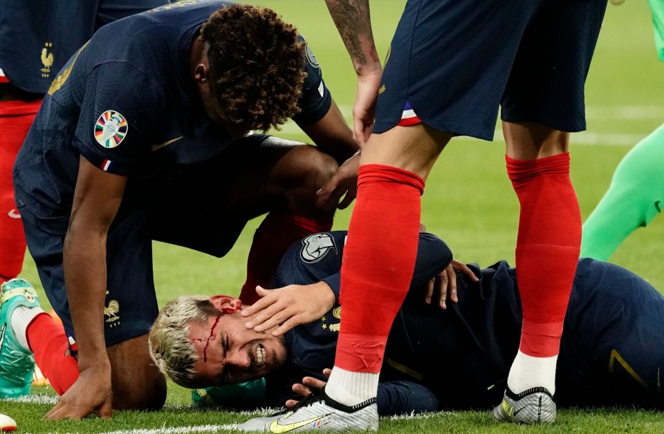Griezmann suffered a nasty gash on his head from Mavropanos' boot