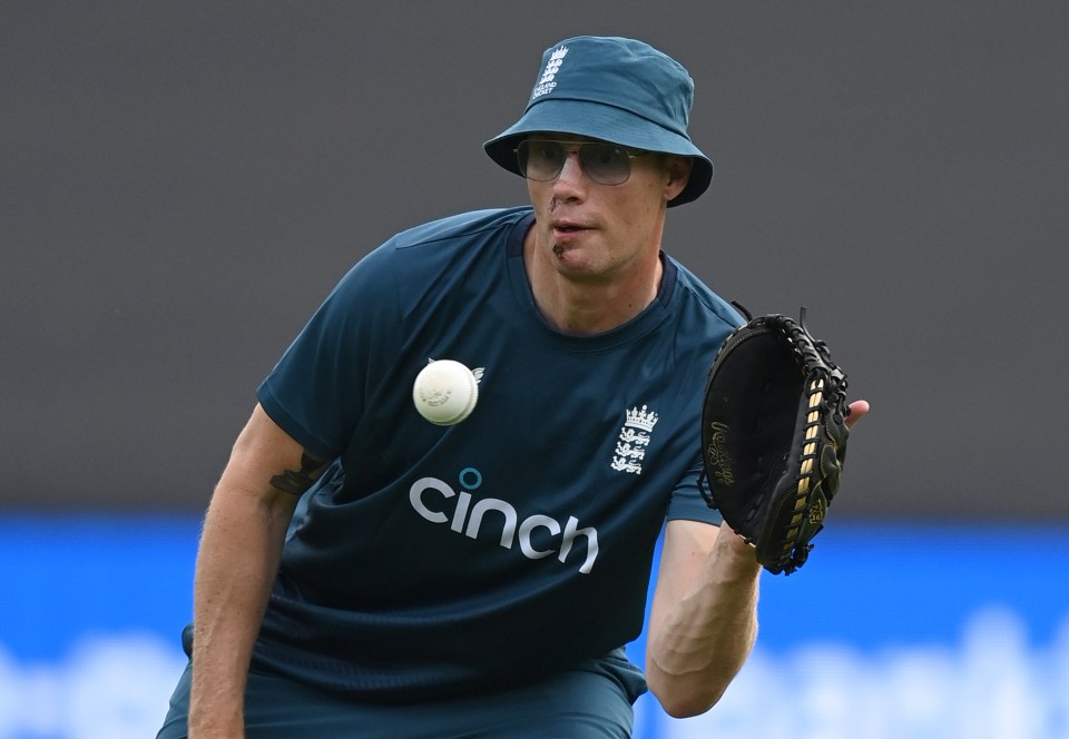 The cricket legend suffered facial injuries and a broken rib after a car accident on the show