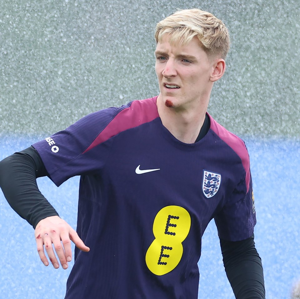 Calls for him to start against Slovakia on Sunday are growing
