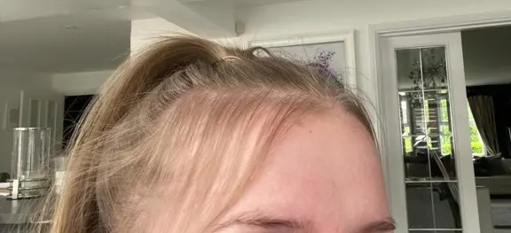 a close up of a woman 's head with the words results so far above it
