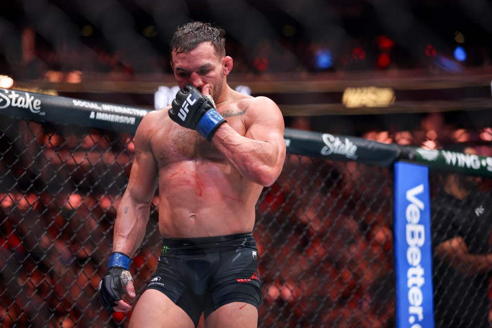 a man in a ufc glove stands in front of a stake banner