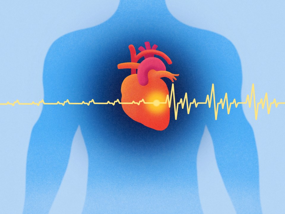 Illustration of a human heart with a pacemaker and ECG line.