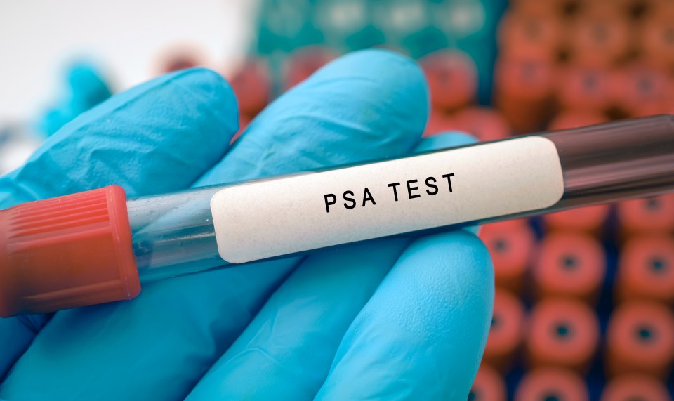 PSA test tube in gloved hand.