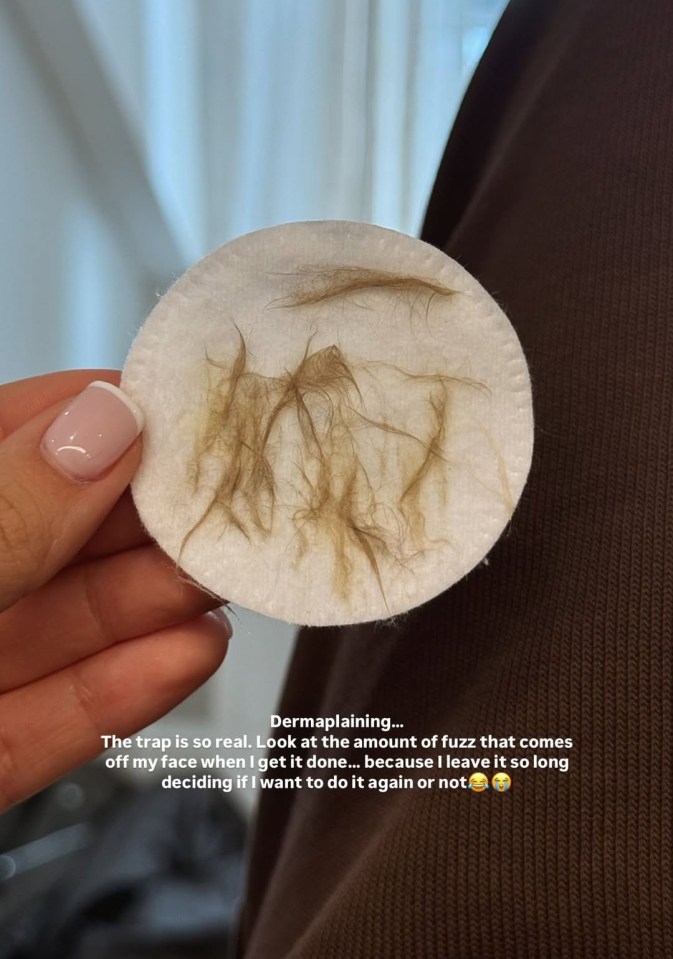 Cotton round with removed facial hair after dermaplaning.