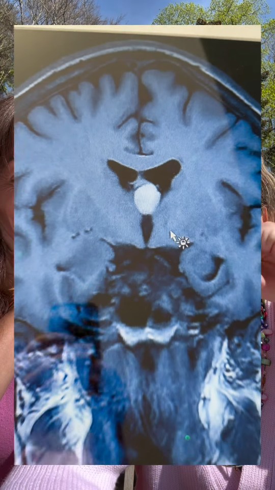 Brain scan displayed between two people.