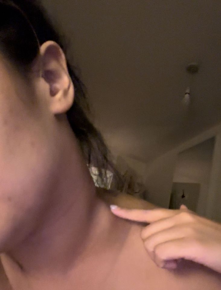 Close-up of a person's neck, pointing to a lump.
