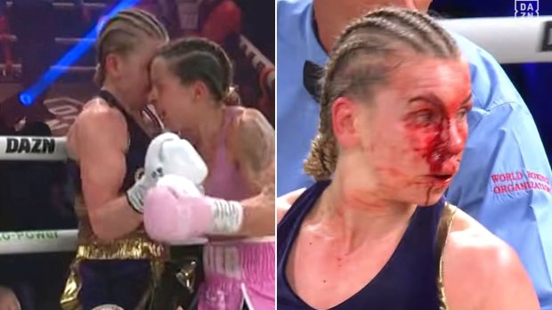 Two female boxers after a match; one boxer's face is severely bloodied.