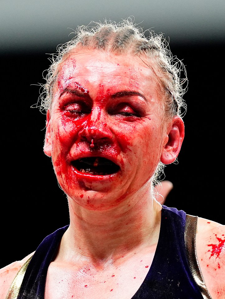 Close-up of a bloody boxer's face.