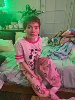 A disabled woman sitting on a bed.