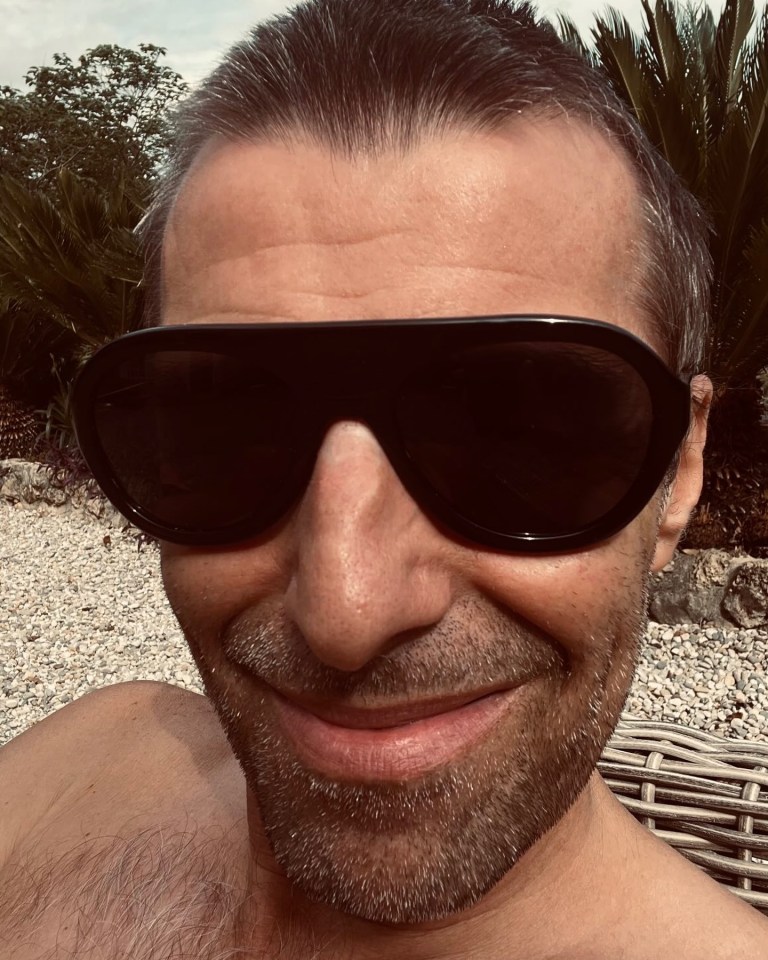 Close-up selfie of Liam Gallagher sunbathing.