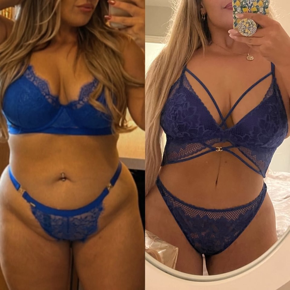 Before and after photos of a woman in blue lingerie following body surgery.