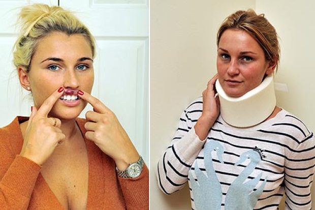 Billy Faiers showing her bruised lip.Sam Faiers from TOWIE talking to The Sun.