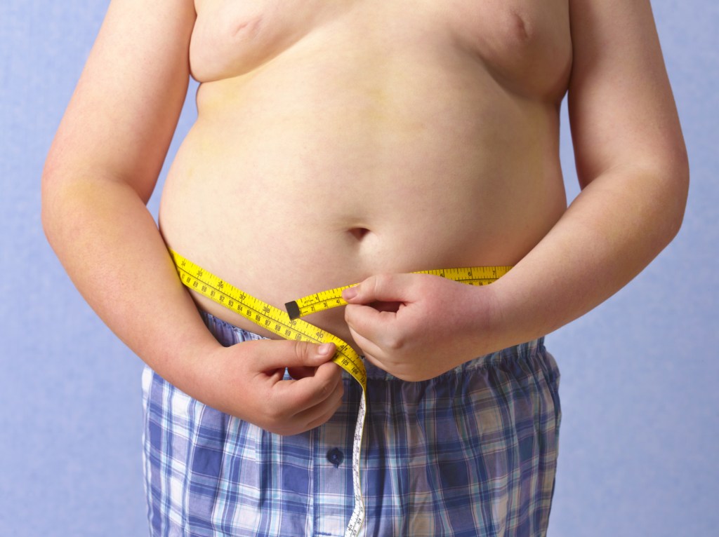Overweight boy