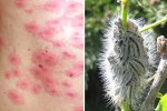 Toxic...A plague of caterpillars which pose a risk to human health have invaded the UK and don't even need to be touched to be dangerous