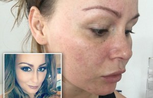 Size 16 Chanelle Hayes reveals two years of yo-yo dieting has made her hair fall out