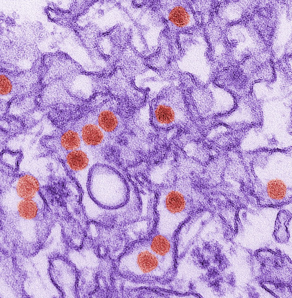 Electron micrograph (TEM) of the Zika virus,