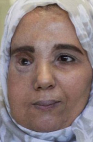 Smaira Benh was disowned by her husband due to a her disfigured face