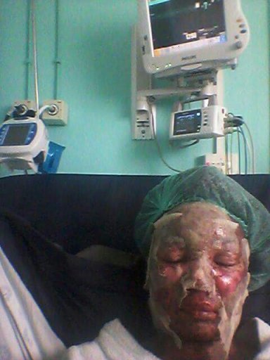Mpho was taken into intensive care at Klerksdorp Hospital in South Africa