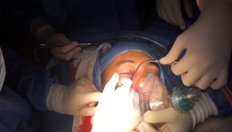 Surgeons performed the delicate operation in the car park of the Bogota hospital after the solider had a grenade blasted into his face