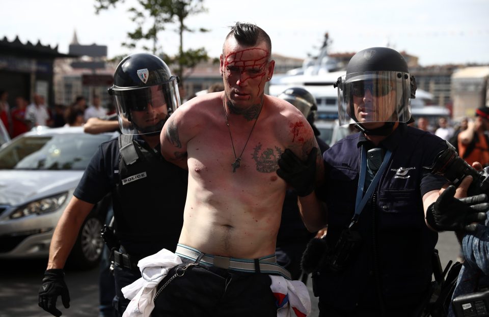 An injured England fan is arrested after clashing with police 