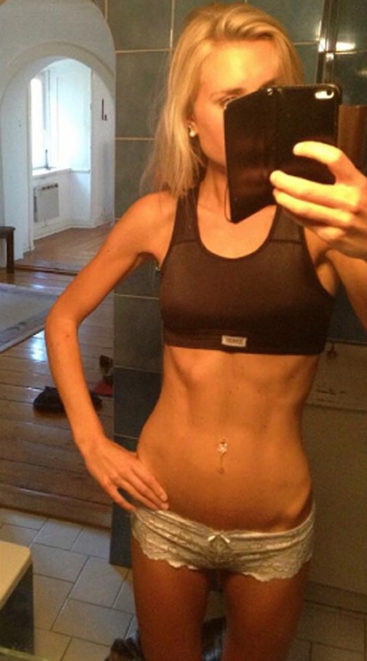 Anorexic recovery
