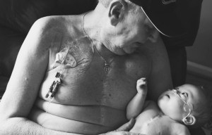 Moving photo shows grandfather and grandson bonding over matching scars after heart surgery