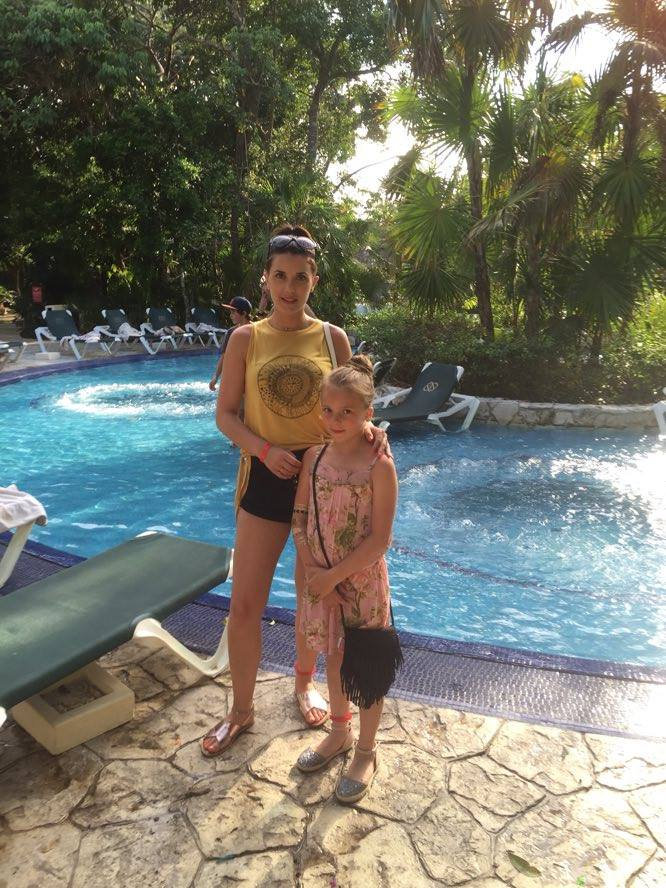 Olivia was enjoying the holiday of a lifetime in Mexico before her legs were burnt by the suntan lotion 