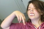Girl believes she is Rihanna after having tooth surgery