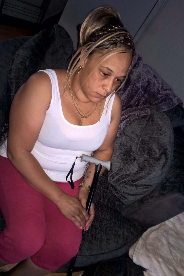 PIC FROM MERCURY PRESS (PICTURED: MICHELLE TURNER, 41, AFTER GETTING CAUDA EQUINA SYNDROME HOLDING A WALKING STICK) A mum-of-four was left incontinent and unable to walk without crutches after A&E doctors missed a serious spinal condition and sent her home. Michelle Turner, 41, has bladder and bowel incontinence and suffers permanent agony after doctors at the Royal Berkshire Hotel missed the signs of cauda equina syndrome - meaning she suffered severe nerve damage. The condition, which causes the nerves in the lower back to suddenly become severely compressed, requires emergency surgery and can result in paralysis and incontinence if left untreated. Michelle, who said the mistake left her "a shadow of her former self" and "devastated her life" - also ending her 12-year relationship - has now received an apology from the hospital. SEE MERCURY COPY