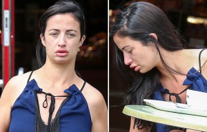 Chantelle Houghton reveals painful looking lips as she steps out without make-up