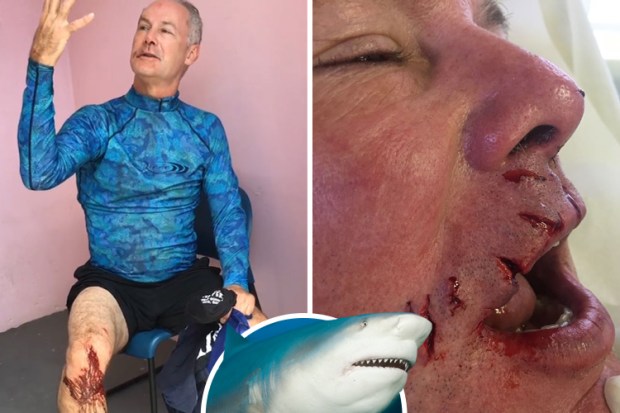 composite shark attack