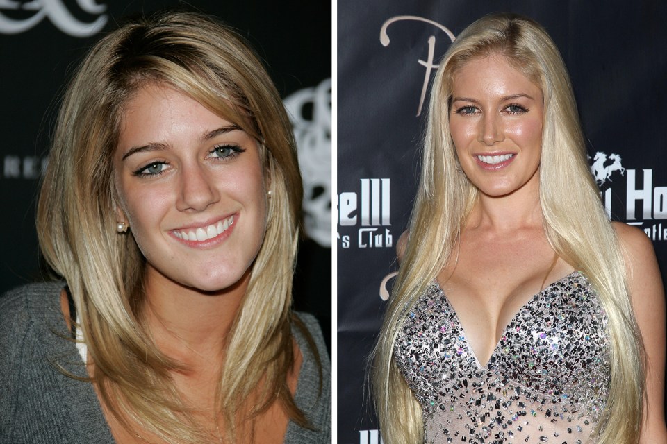 Fans were astounded by the changes to Heidi 