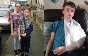 Brave young girl saves little brother’s life after he was struck in hit and run