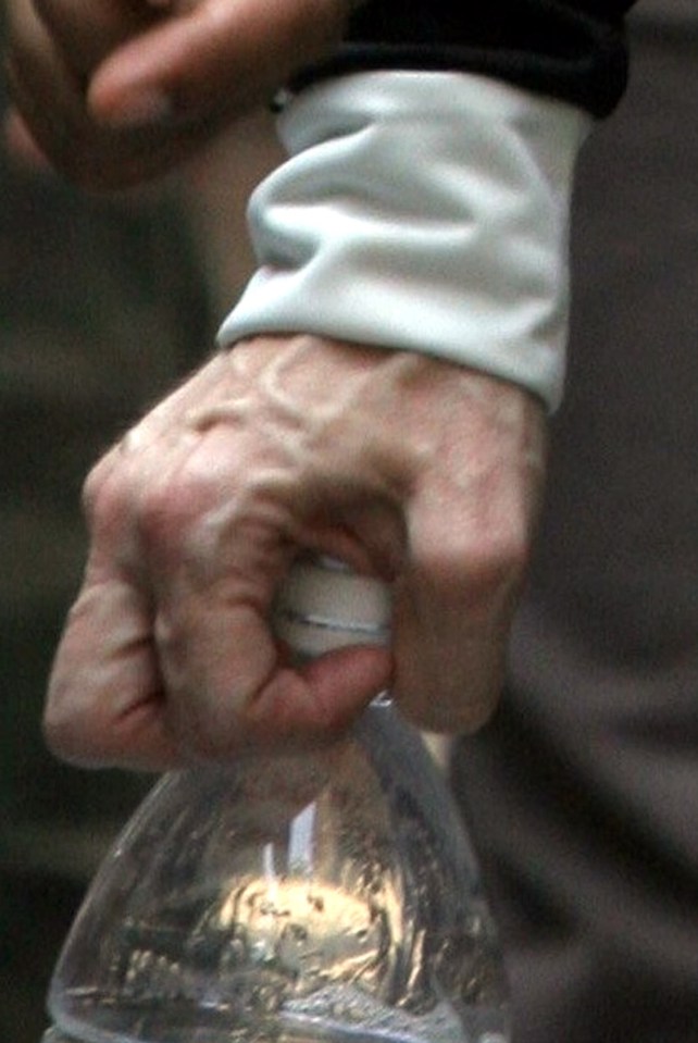 Madonna's hands before the treatment 