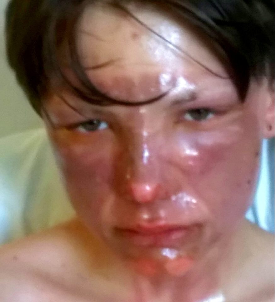 The youngster was rushed to Queens Medical Centre after the terrifying accident