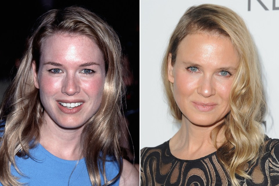 The shock trasnformation of Renée Zellweger is due to more than just make up