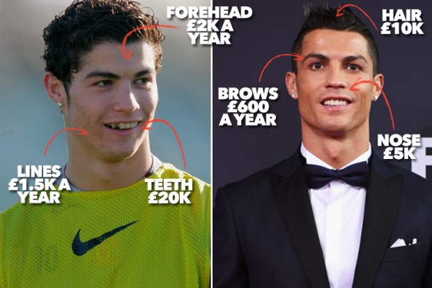 Ronaldo