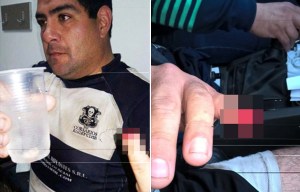 Rugby player has finger bitten clean off by a member of the opposition in sickening attack