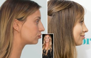 Ferne McCann reveals Charlotte Crosby gave her advice before she went under the knife for her nose job
