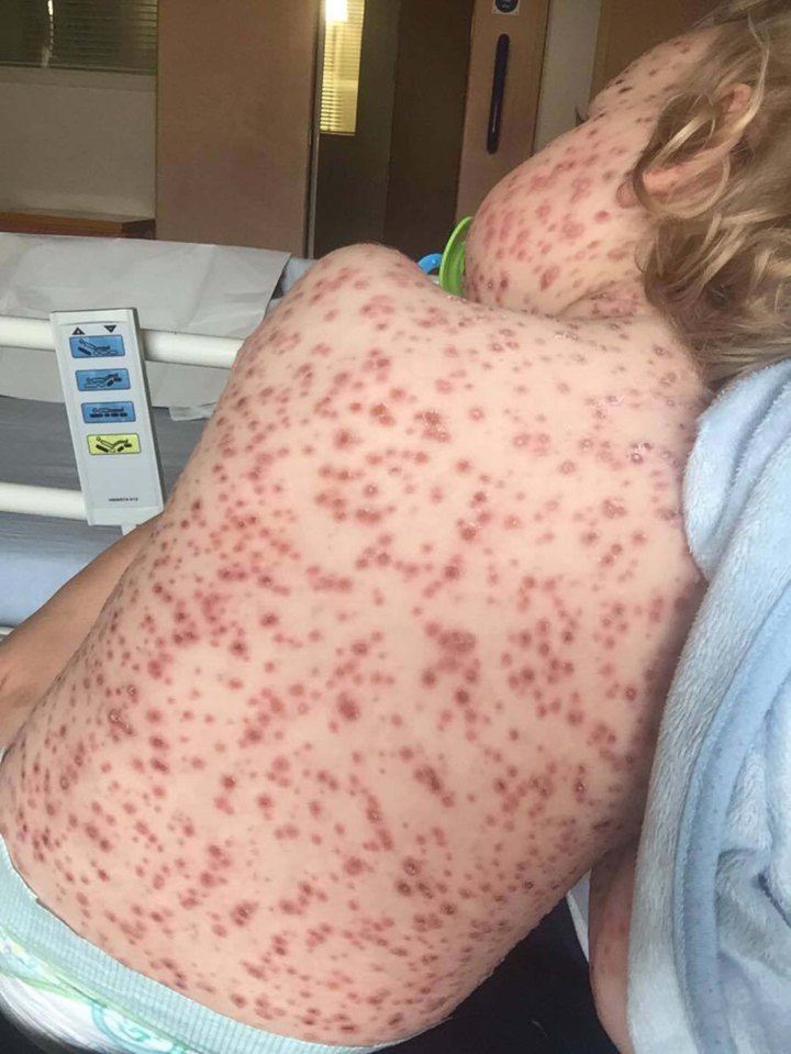 Mum Sarah claims less than 48 hours before he was rushed to hospital she was refused an appointment at her local GP surgery