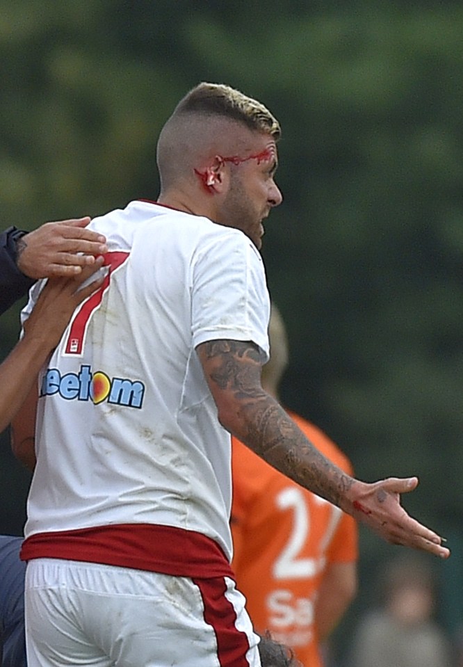 Jeremy Menez suffered a horrible cut to his ear in a friendly