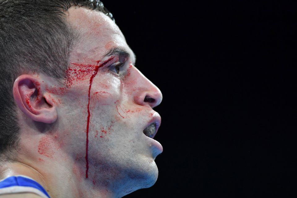 Blood drips down Algeria's Reda Benbaziz's face as he fights against Russia's Adlan Abdurashidov